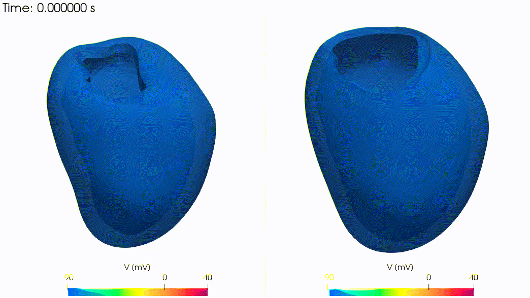 electrophysiology_electromechanics_VT