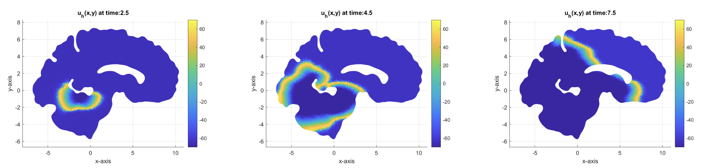 An adaptive discontinuous Galerkin method for the numerical modeling of epileptic seizures, Caterina Beatrice Leimer Saglio, 2021. Advisor: Prof. Paola F. Antonietti, Co-Advisor: S. Pagani, M. Corti