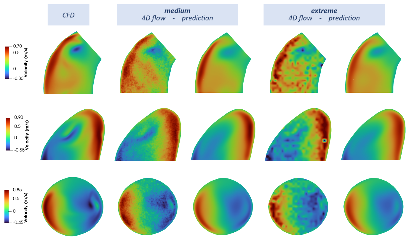 Aortic wall shear stress quantification from 4D flow data with Physics-Informed Neural Networks, Francesco Songia, 2022. Advisor: Stefano Pagani, Co-advisors: Francesco Regazzoni, Simone Saitta
